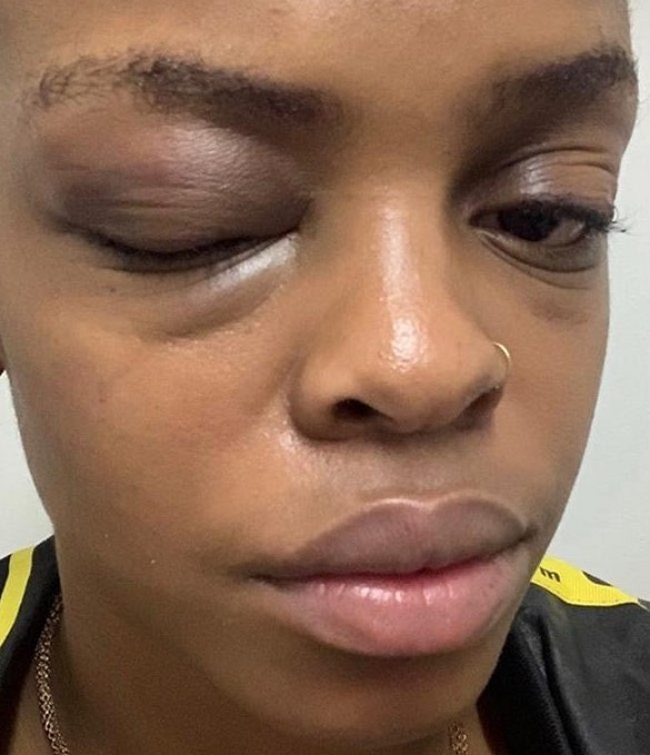 #JusticeforLebo: Stellenbosch University student Lebo Masinga sexually violated and assaulted by a final year medical student