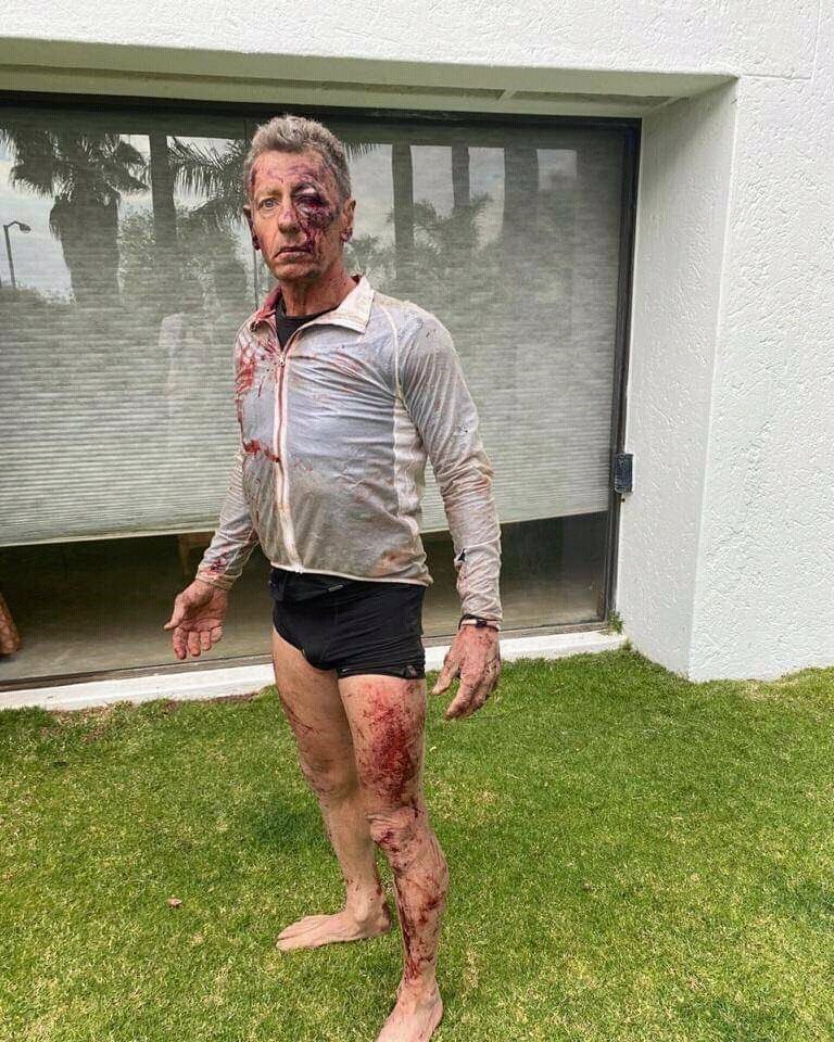 Comrades Marathon champion, Nick Bester attacked while jogging