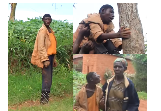 Boy with microcephaly in Gambia. Looks like a chimpanzee in Gambia