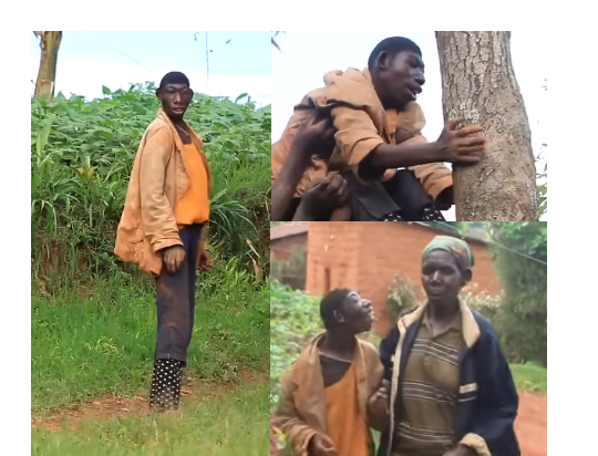 Boy with microcephaly in Gambia. Looks like a chimpanzee in Gambia