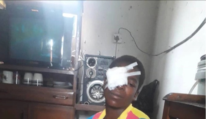 I told my husband to remove his shoes, wife laments after hubby plucks off her eye
