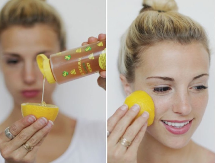 6 Natural ways to get rid of white and blackheads in few days