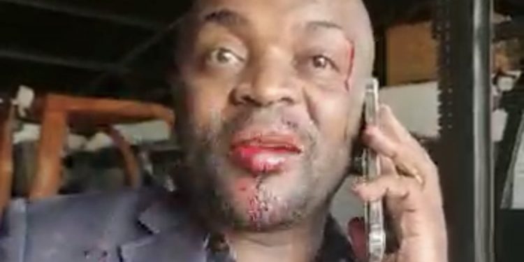 Video: Former Mayor of Pretoria Solly Msimanga beaten up