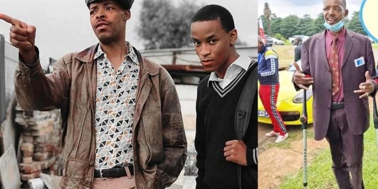 Israel Matseke Zulu amputated leg