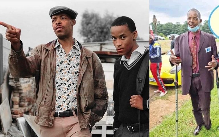 In Pictures: Gomora actor Israel Matseke Zulu’s amputated leg revealed for the first time