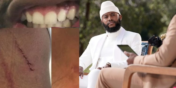 Pictures: Mohale releases pictures of his alleged assault by Somizi, and photos of his damaged car