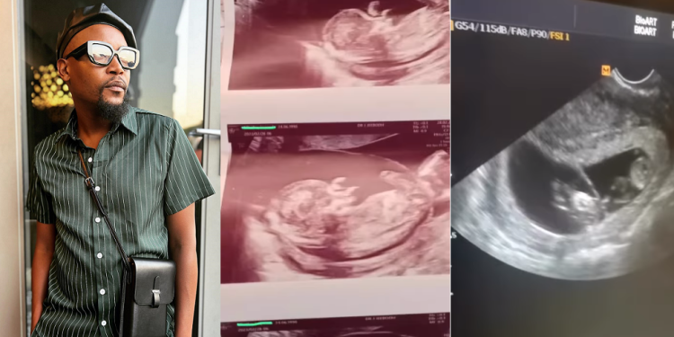 Moshe Ndiki expecting twins via a surrogate